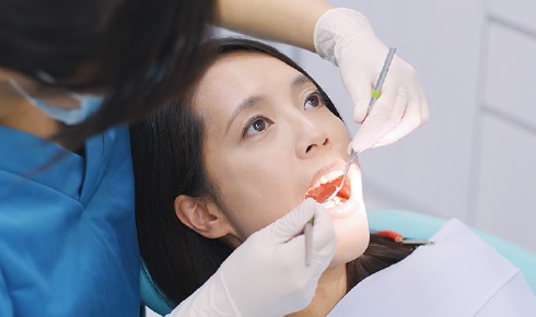 歯周病の治療のイメージ写真