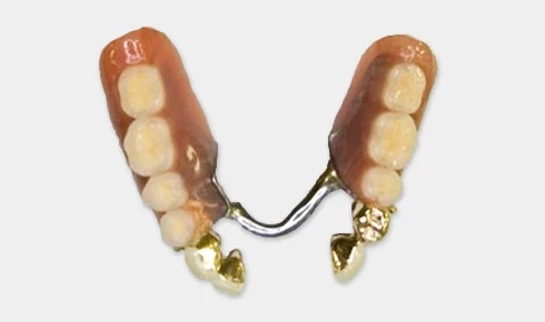 コーヌス・テレスコープ義歯のイメージ写真